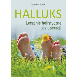 Halluks. Leczenie holistyczne bez operacji